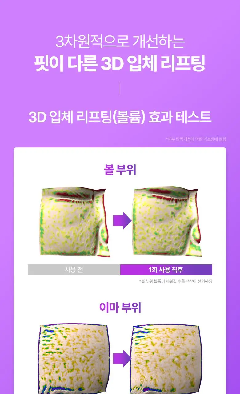 [최다증정|기프트] 바이오힐보 프로바이오덤 3D리프팅 스킨케어 3종세트(토너+에멀전+크림) 상세페이지 11